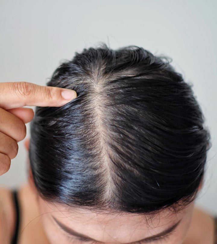 The Science Behind Anti-Hairfall